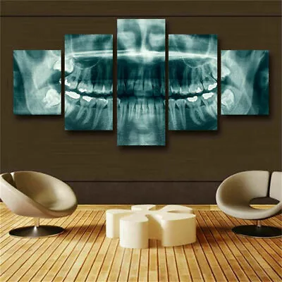 Dental Teeth X-Ray Dentist 5 Piece Canvas Wall Art Print Poster Home Decor • $23.50