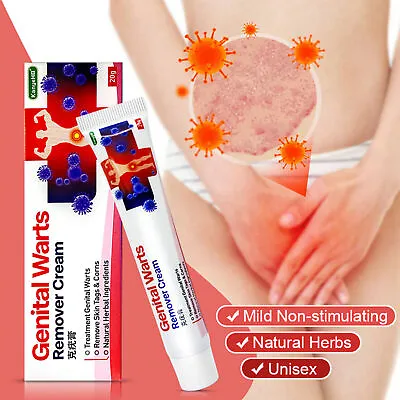 Genital Herpes Wart Remover Ointment Skin Tag Mole Acuminatum Treatment Cream UK • £6.19