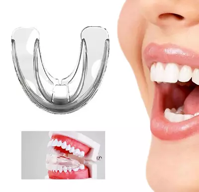 Stage 1 Dental Mouth Guard Teeth Corrector Braces Retainer Straighten Tool • $7.97