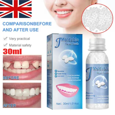 30g Resin Granules Tooth Gap Repair FalseTeeth Solid Glue Moldable Teeth And Gap • £7.95