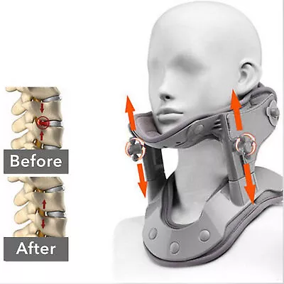 Cervical Neck Traction Device Multifunctional Electric Neck Stretcher For Adults • £35