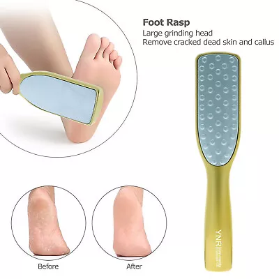 Foot File Hard Dead Skin Callus Remover Rasp Scraper Scrubber Dual Sided Rasp  • £5.99