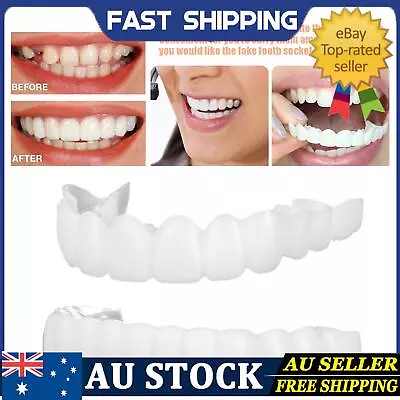  Instant Smile Veneers Kit - Silicone Material - White - Perfect Dental Beauty  • $5.69