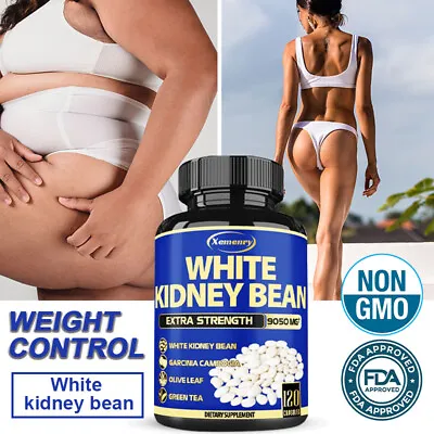 White Kidney Bean 9050mg - Lose Weight Carb Blockers Appetite Suppressant • £12.48