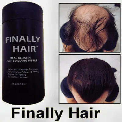 Hair Fibers Conceal Hair Loss Thinning Hair Balding Areas Keratin Finally Hair! • $14