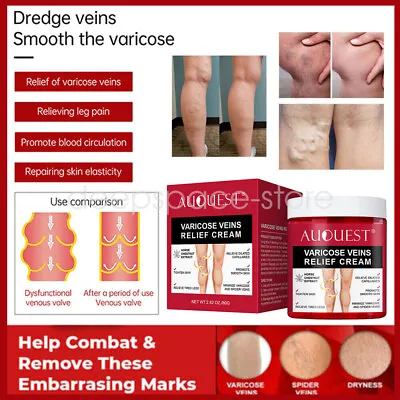 Varicose Veins Relief Cream Relieve Tired Legs Spider Pain Tighten Smooth Skin • £8.39