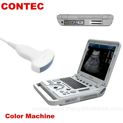 £3337 • Buy Color Doppler Portable Ultrasound Scanner Laptop Machine Convex Abdominal Probe