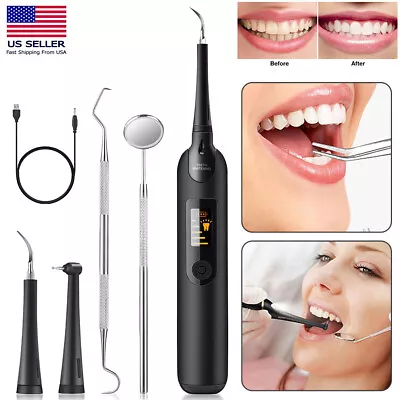 $22.27 • Buy Ultrasonic Tooth Cleaner Dental Plaque Calculus Stain Remover Teeth Cleaning Kit