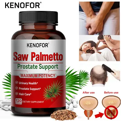 Saw Palmetto Prostate Support – Immune System And Hair Health • $17.97