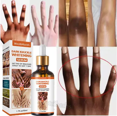 $8.95 • Buy Extra Strong Whitening Serum Oil For Removing Dark Knuckle Finger Elbow And Knee