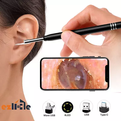 Otoscope Ear Wax Cleaner Scope LED Camera Scoop Pick Removal Tool Endoscope • $13.55