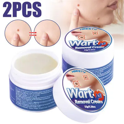 2* Warts Removal Cream Face Neck Foot Mole Corn Skin Care Tag Remover Treatments • £3.95