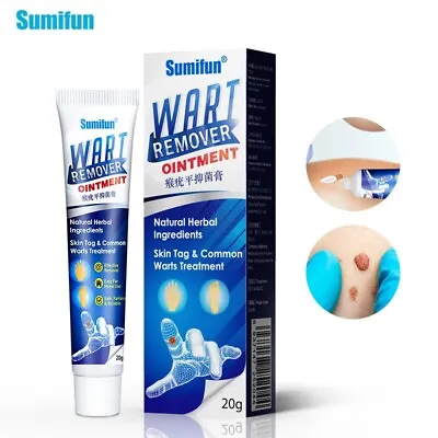 Wart Removal Treatment Cream Plantar Flat Filiform Periungual Common Skin Tag • £4.49