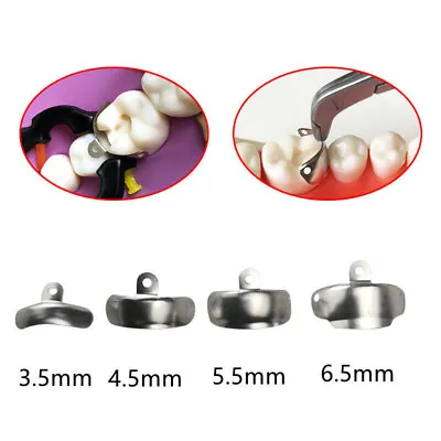 50 Pcs Dental Matrix Bands Palodent V3 Style Sectional Contoured Matrices 8 Size • $12.34