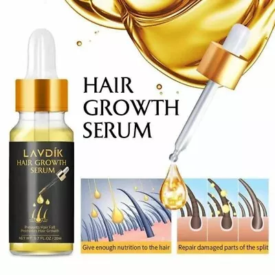 Hair Growth Serum Grow Hair Fast Hair Loss Treatment For Men & Women  • £4.99