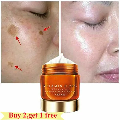 £7.95 • Buy Vitamin C Face Cream Face Whitening Repair Fade Freckles Remove Dark Spot Serum