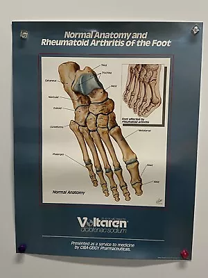 Poster Human Normal Anatomy & Rheumatoid Arthritis Of The Foot 19  X 15  • $12.99