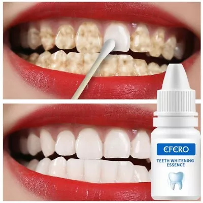 2023 Instant Tooth Whitening Kit White Teeth Clean Gel Uv Bleach Dental Strength • $12.45