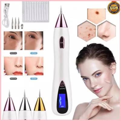 Electri Laser Skin Tag Freckle Wart Dot Mole Remove Pen Dark Spot Tattoo Removal • $20.95