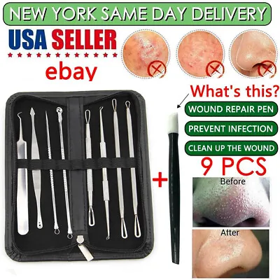 $8.38 • Buy Blackhead Whitehead Pimple Spot Comedone Extractor Remover Popper Tools Kit 9Pcs