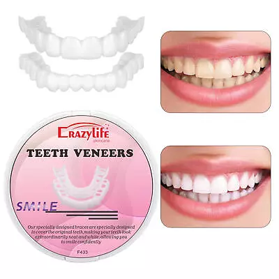 Snap On Pair Upper And Lower Smile Cosmetic Dental White Teeth Denture Veneers • $8.98