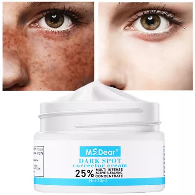 Whitening Freckle Cream Face Moisturizing Remove Dark Spots Melanin Melasma 30ml • £7.45