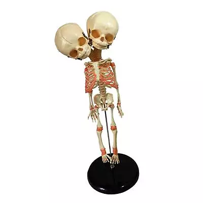 Baby Deformed Head Skull Model With Base Human Anatomical Model For Teaching • £37.15