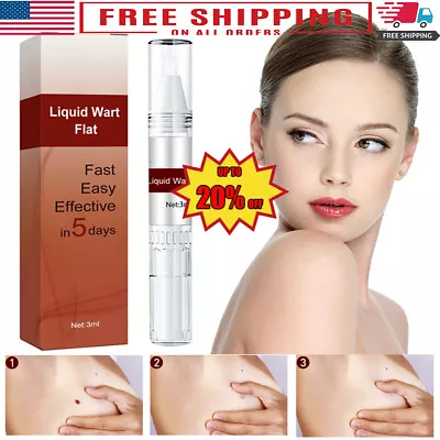 Skin Tag Mole Remover Pen Neck Face Bady Skin Freeze Off Wart Remover Painless • $6.69