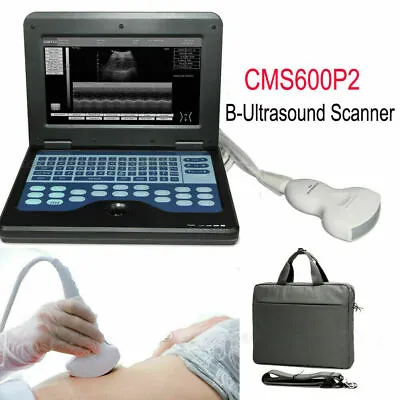 CMS600P2 Portable Ultrasound Scanner Laptop Ultrasound Machine 3.5M Convex Probe • £1112