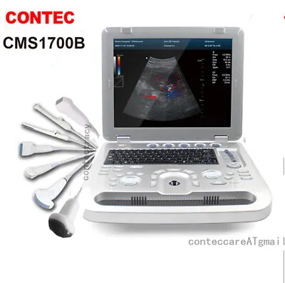 CONTEC Color Doppler Ultrasound Scanner Portable Laptop Machine Optional 7 Probe • £703
