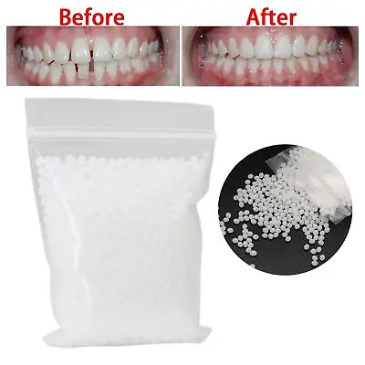 100g Adhesive Temporary Tooth Repair Kit Fix Broken Teeth And Fills Gaps • £7.98