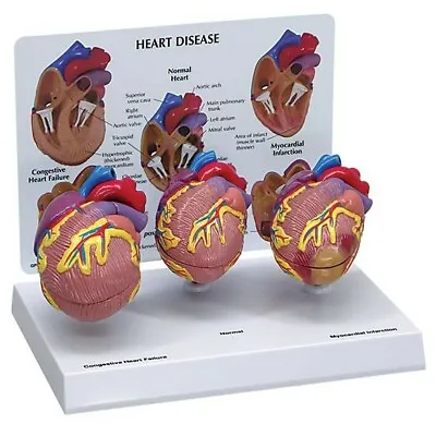 Mini-Heart Anatomical Model Set Of 3  GPI  LFA #2550 See VIDEO! • $127.50
