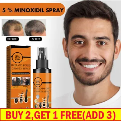 5 % Minoxidil Hair Growth Spray For Men Women Treatment Regrowth Hair 100ml UK • £6.79