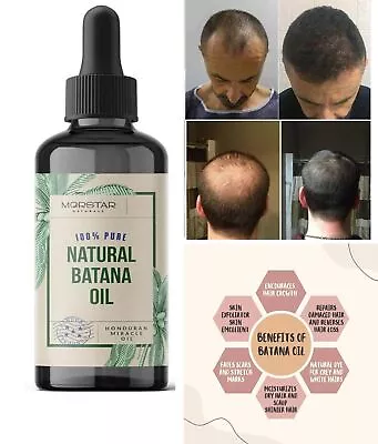 100% Organic Batana Oil From Honduras Natural Hair Growth (30ml - 1 Fl Oz) • $17.59