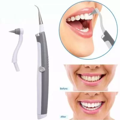 £6.31 • Buy Tooth Cleaner Calculus Plaque Remover Dental Washer Sonic Dental Scaler