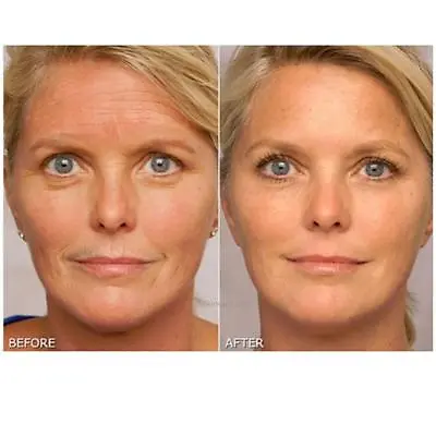 Anti Wrinkle Cream Instant Face Lift fine Line Cream. Works Instantly!🌟🌟🌟🌟 • £19.90