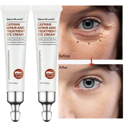 £10.45 • Buy 2Pcs Eye Cream Anti Aging For Dark Circles And Remove Puffiness Bags Under Eyes