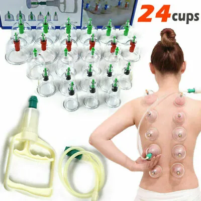 $13.99 • Buy 24Cups Set Medical Chinese Body Vacuum Cupping Healthy Suction Therapy Massage