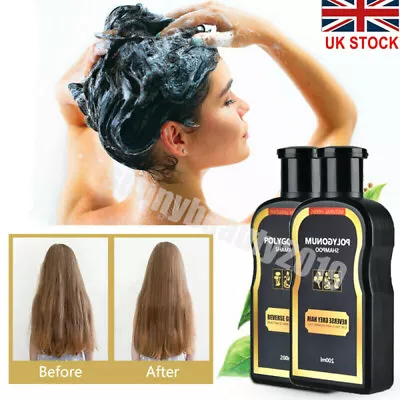 5x 200ml Reverse Grey Hair Darkening Shampoo Natural Polygonum Essence Hair Care • £9.95