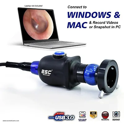 Endoscopy Camera HD Portable USB Rigid Endoscope Storz ENT Medical 1.2MP Windows • $375