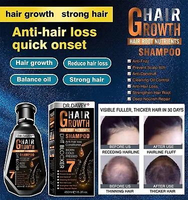 Hair Growth Shampoo Hair Regrowth Treatment Anti-Hair Loss Shampoo For Men Women • $17.75