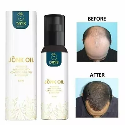 New Arrival Smoothing Repairing Anti Loss Regrowth Scalp Elixirs Hair Growth Oil • $41.78