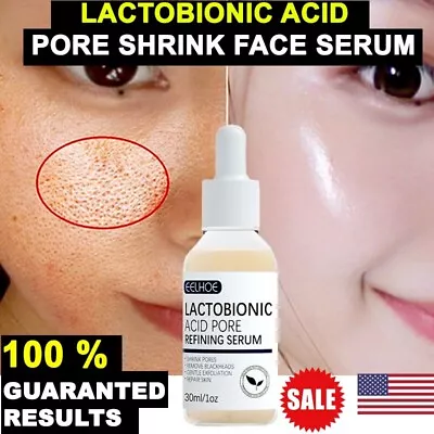 $11.79 • Buy Face Whitening Cream For Dark Skin Spots Scars Snow Day Night Face White Cream ✅
