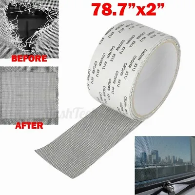 Window Screen Repair Patch Adhesive Repaire Tape Fiberglass Mesh Hole 2 X79  • $5.91