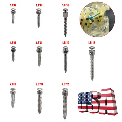 $3.99 • Buy Dental Orthodontic Micro Implants Mini Screw Self-Drilling 10 Different Sizes
