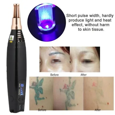 $78 • Buy Handheld Picosecond Laser Pen Scar Freckle Tattoo Removal Machine Beauty Skin