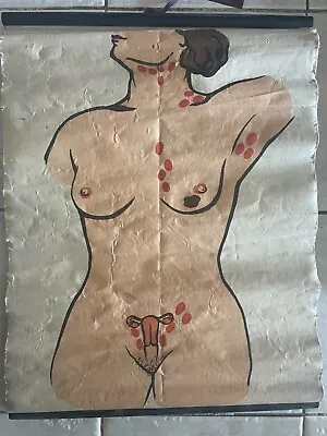 Original Vintage Medical  Chart Of Uterus Vagina Fetus Cancer 4x Posters • $120