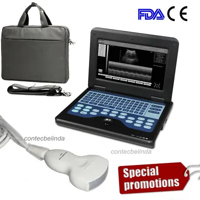 Portable Laptop Ultrasound Scanner Machine Digital Human Use 3.5Mhz Convex Probe • $1249