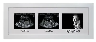 Ultrasound Pregnancy Baby Scan 1st Photo White Triple Aperture Frame 12 20 Week • £16.95