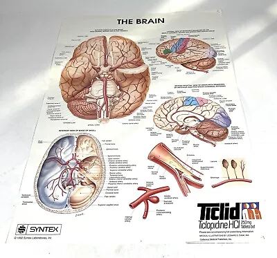 The Brain Syntex Ticlid Vintage 1992 Poster Medical Dr. Office • $54.59